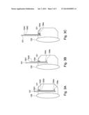 HEADPHONE DEVICE diagram and image