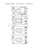 APPARATUS AND METHOD FOR PROCESSING IMAGE IN DEVICE HAVING CAMERA diagram and image