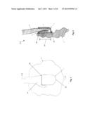 DEVICE WITH ATTACHED STORAGE POUCH diagram and image