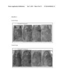 CONJUGATES OF NITROIMIDAZOLES AND THEIR USE AS CHEMOTHERAPEUTIC AGENTS diagram and image