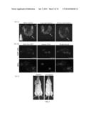 Oxide Ferrimagnetics with Spinel Structure Nanoparticles and Iron Oxide     Nanoparticles, Biocompatible Aqueous Colloidal Systems Comprising     Nanoparticles, Ferriliposomes, and Uses Thereof diagram and image