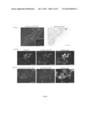 Oxide Ferrimagnetics with Spinel Structure Nanoparticles and Iron Oxide     Nanoparticles, Biocompatible Aqueous Colloidal Systems Comprising     Nanoparticles, Ferriliposomes, and Uses Thereof diagram and image