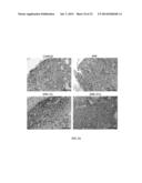 Oxide Ferrimagnetics with Spinel Structure Nanoparticles and Iron Oxide     Nanoparticles, Biocompatible Aqueous Colloidal Systems Comprising     Nanoparticles, Ferriliposomes, and Uses Thereof diagram and image