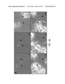 Use of Stem Cells to Prevent Neuronal Dieback diagram and image