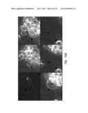 Use of Stem Cells to Prevent Neuronal Dieback diagram and image