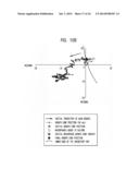 Use of Stem Cells to Prevent Neuronal Dieback diagram and image