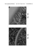 Use of Stem Cells to Prevent Neuronal Dieback diagram and image