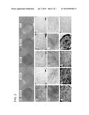 COMPOSITIONS FOR DIRECTING ADIPOSE-DERIVED STEM CELLS TO A CHONDROGENIC     DIFFERENTIATION AND METHODS OF USE THEREFOR diagram and image