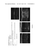 COMPOSITIONS AND METHODS FOR TREATING RETINAL DISEASES diagram and image