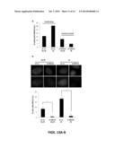 DIAGNOSING SUBSETS OF TRIPLE-NEGATIVE BREAST CANCER diagram and image