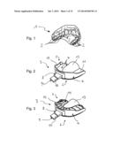 IMPRESSION TRAY, AND METHOD FOR CAPTURING STRUCTURES, ARRANGEMENTS OR     SHAPES, IN PARTICULAR IN THE MOUTH OR HUMAN BODY diagram and image