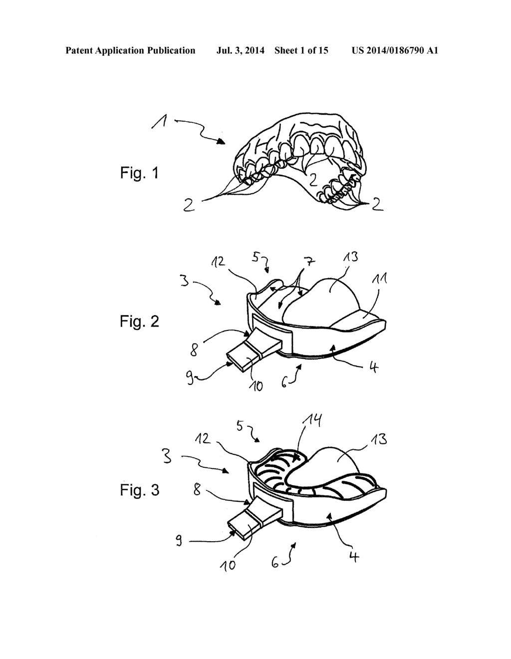 IMPRESSION TRAY, AND METHOD FOR CAPTURING STRUCTURES, ARRANGEMENTS OR     SHAPES, IN PARTICULAR IN THE MOUTH OR HUMAN BODY - diagram, schematic, and image 02