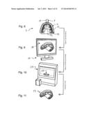 IMPRESSION TRAY, AND METHOD FOR CAPTURING STRUCTURES, ARRANGEMENTS OR     SHAPES, IN PARTICULAR IN THE MOUTH OR HUMAN BODY diagram and image