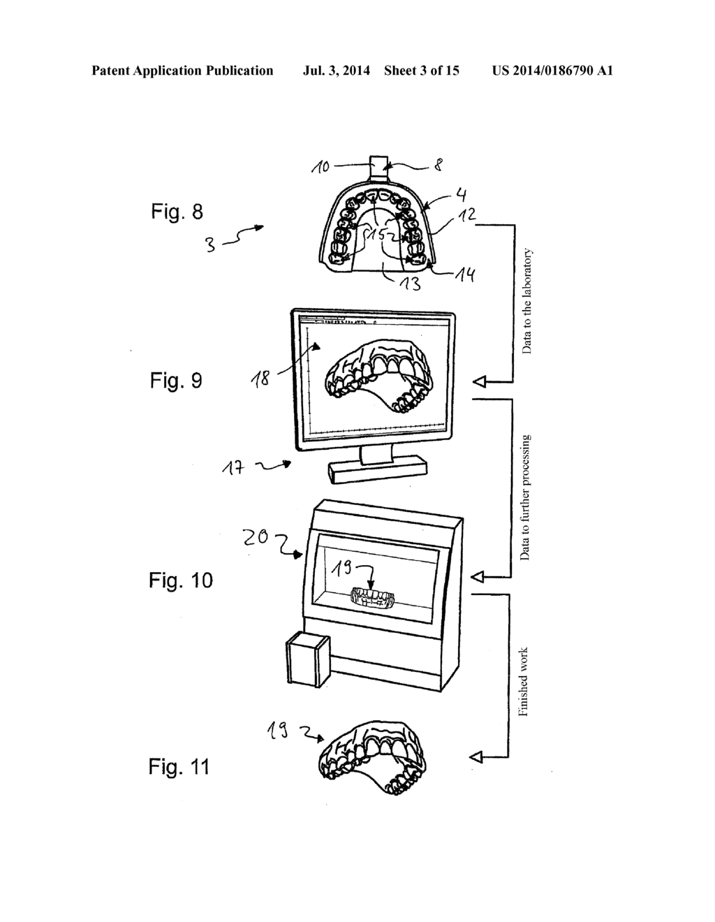 IMPRESSION TRAY, AND METHOD FOR CAPTURING STRUCTURES, ARRANGEMENTS OR     SHAPES, IN PARTICULAR IN THE MOUTH OR HUMAN BODY - diagram, schematic, and image 04