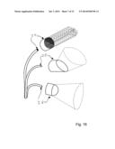 IMPRESSION TRAY, AND METHOD FOR CAPTURING STRUCTURES, ARRANGEMENTS OR     SHAPES, IN PARTICULAR IN THE MOUTH OR HUMAN BODY diagram and image