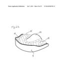 IMPRESSION TRAY, AND METHOD FOR CAPTURING STRUCTURES, ARRANGEMENTS OR     SHAPES, IN PARTICULAR IN THE MOUTH OR HUMAN BODY diagram and image