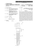 DENTAL IMPLANT diagram and image