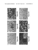 Optimized Methods for Differentiation of Cells Into Cells with Hepatocyte     and Hepatocyte Progenitor Phenotypes, Cells Produced by the Methods, and     Methods for Using the Cells diagram and image