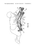 EXERCISE DEVICE AND METHODS FOR USING THE EXERCISE DEVICE diagram and image