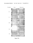 LOWER DOSAGE STRENGTH IMIQUIMOD FORMULATIONS AND SHORT DOSING REGIMENS FOR     TREATING GENITAL AND PERIANAL WARTS diagram and image