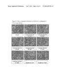 DIPHENYL ETHER COMPOUNDS FOR THE TREATMENT OF LIVER, LUNG DISORDERS,     DIABETIC COMPLICATIONS AND CARDIOVASCULAR DISEASES diagram and image