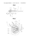 ENDOSCOPE diagram and image