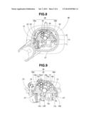 ENDOSCOPE diagram and image