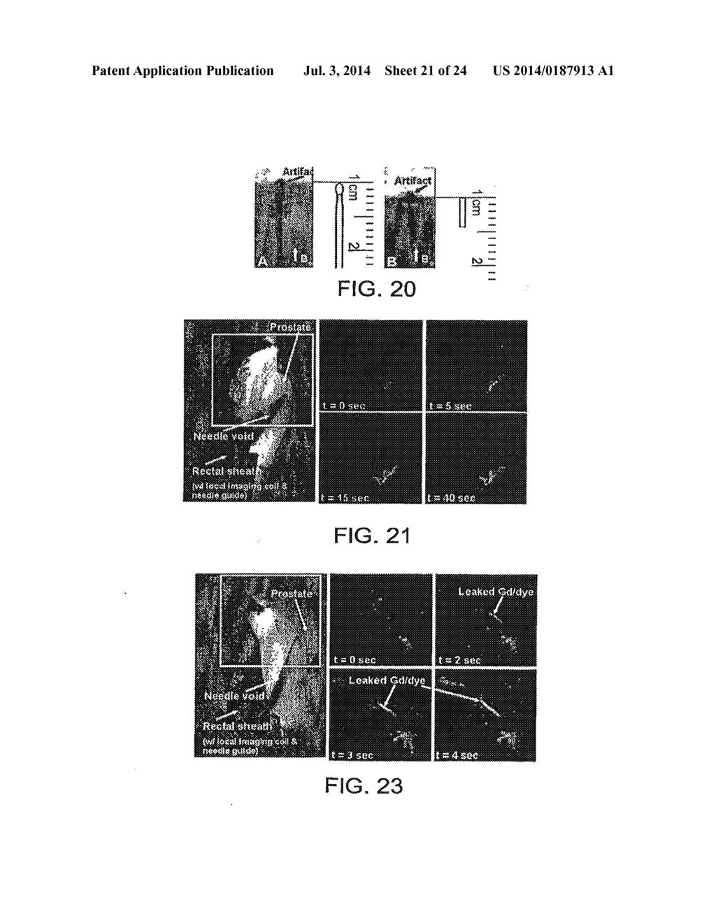 APPARATUS FOR INSERTION OF A MEDICAL DEVICE DURING A MEDICAL IMAGING     PROCESS - diagram, schematic, and image 22