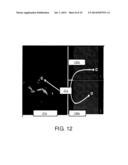 MPR SLICE SELECTION FOR VISUALIZATION OF CATHETER IN THREE-DIMENSIONAL     ULTRASOUND diagram and image