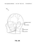 NONINVASIVE TISSUE TIGHTENING SYSTEM diagram and image