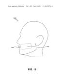 NONINVASIVE TISSUE TIGHTENING SYSTEM diagram and image