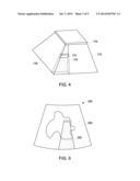 ULTRASOUND IMAGING SYSTEM AND METHOD FOR IDENTIFYING DATA FROM A SHADOW     REGION diagram and image