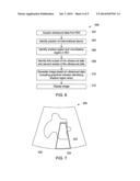 ULTRASOUND IMAGING SYSTEM AND METHOD FOR IDENTIFYING DATA FROM A SHADOW     REGION diagram and image