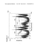 Spectrum analysis of coronary artery turbulent blood flow diagram and image