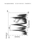 Spectrum analysis of coronary artery turbulent blood flow diagram and image