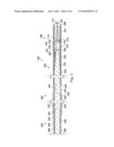 Guidewire Devices and Methods diagram and image