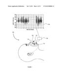 BREATHING DISORDER IDENTIFICATION, CHARACTERIZATION AND DIAGNOSIS METHODS,     DEVICES AND SYSTEMS diagram and image