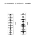 BREATHING DISORDER IDENTIFICATION, CHARACTERIZATION AND DIAGNOSIS METHODS,     DEVICES AND SYSTEMS diagram and image