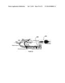 BREATHING DISORDER IDENTIFICATION, CHARACTERIZATION AND DIAGNOSIS METHODS,     DEVICES AND SYSTEMS diagram and image