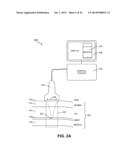 ENERGY-BASED TISSUE TIGHTENING SYSTEM diagram and image