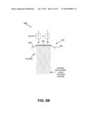 ENERGY-BASED TISSUE TIGHTENING SYSTEM diagram and image