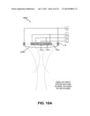 ENERGY-BASED TISSUE TIGHTENING SYSTEM diagram and image