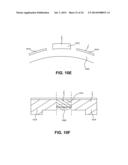 ENERGY-BASED TISSUE TIGHTENING SYSTEM diagram and image