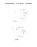 SYSTEMS AND METHOD FOR BYPASSING AN ANASTOMOSIS SITE diagram and image