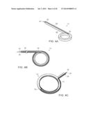 SYSTEMS AND METHOD FOR BYPASSING AN ANASTOMOSIS SITE diagram and image