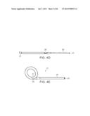 SYSTEMS AND METHOD FOR BYPASSING AN ANASTOMOSIS SITE diagram and image