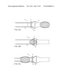 SYSTEMS AND METHOD FOR BYPASSING AN ANASTOMOSIS SITE diagram and image