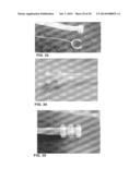 SYSTEMS AND METHOD FOR BYPASSING AN ANASTOMOSIS SITE diagram and image