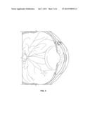 Ocular Pressure Regulation diagram and image