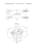 Methods and Apparatus for Neuromodulation Utilizing Optical-Acoustic     Sensors diagram and image